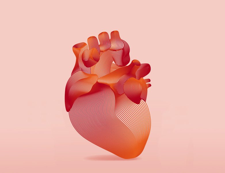 пересадка сердца от донора с остановкой кровообращения картинка